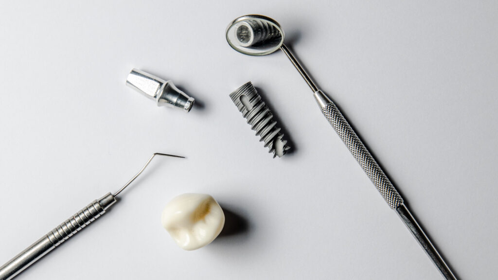 koliko traje ugradnja implantata u dental centru ostojic