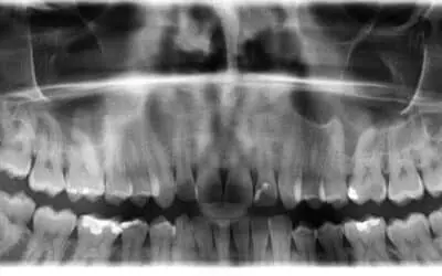 Sve rendgenske pretrage zuba na jednom mjestu